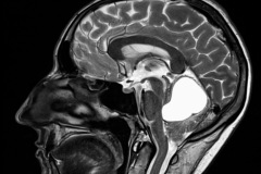 Screen-Shot-2018-01-23-at-11.45.35